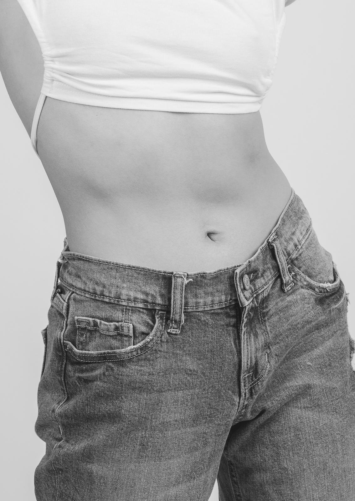 Why Is Yellow Bottle So Popular for Small Fat Removal?