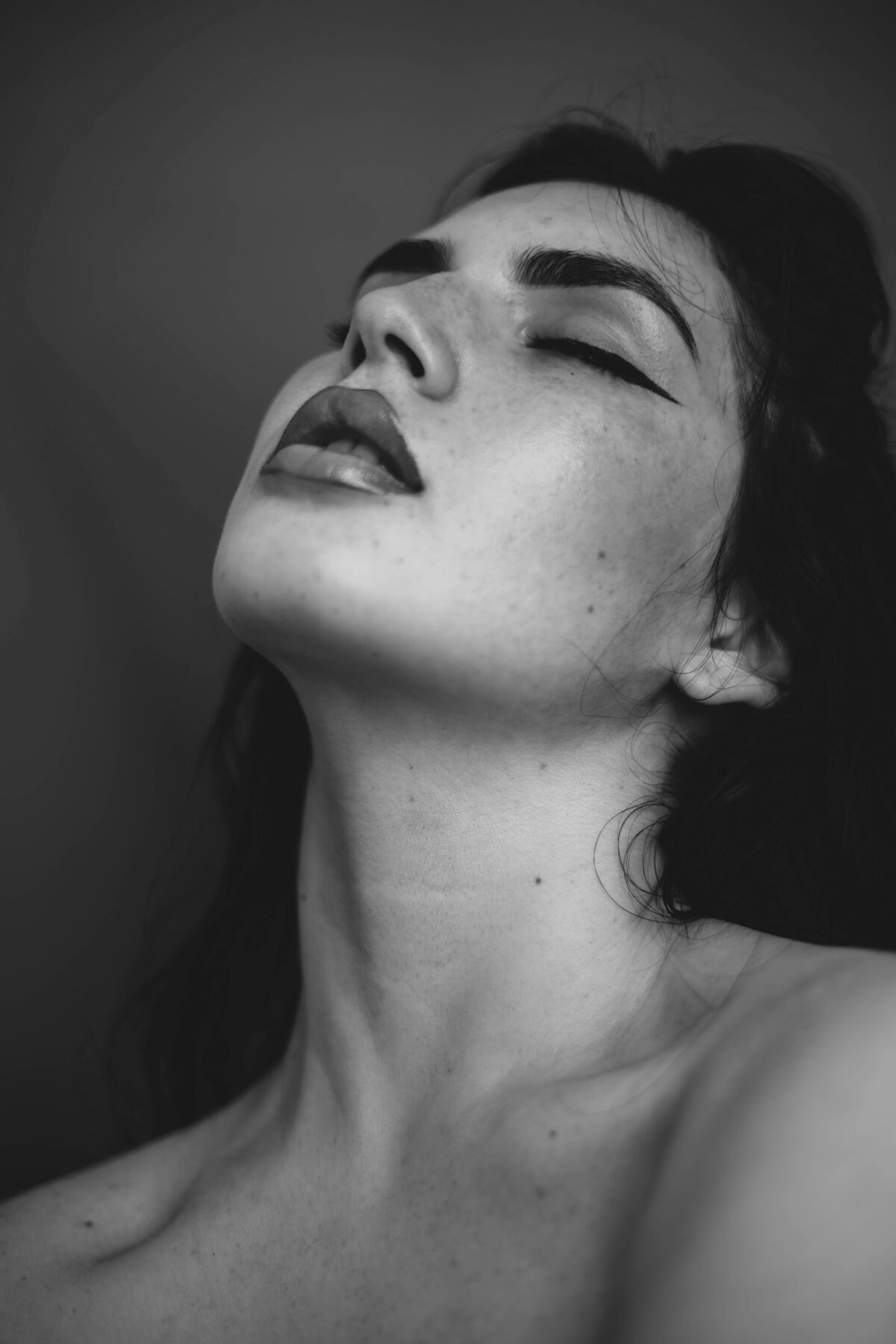 Nose Dermal Filler