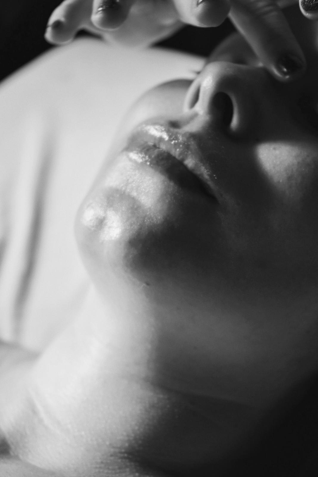 Mesotherapy