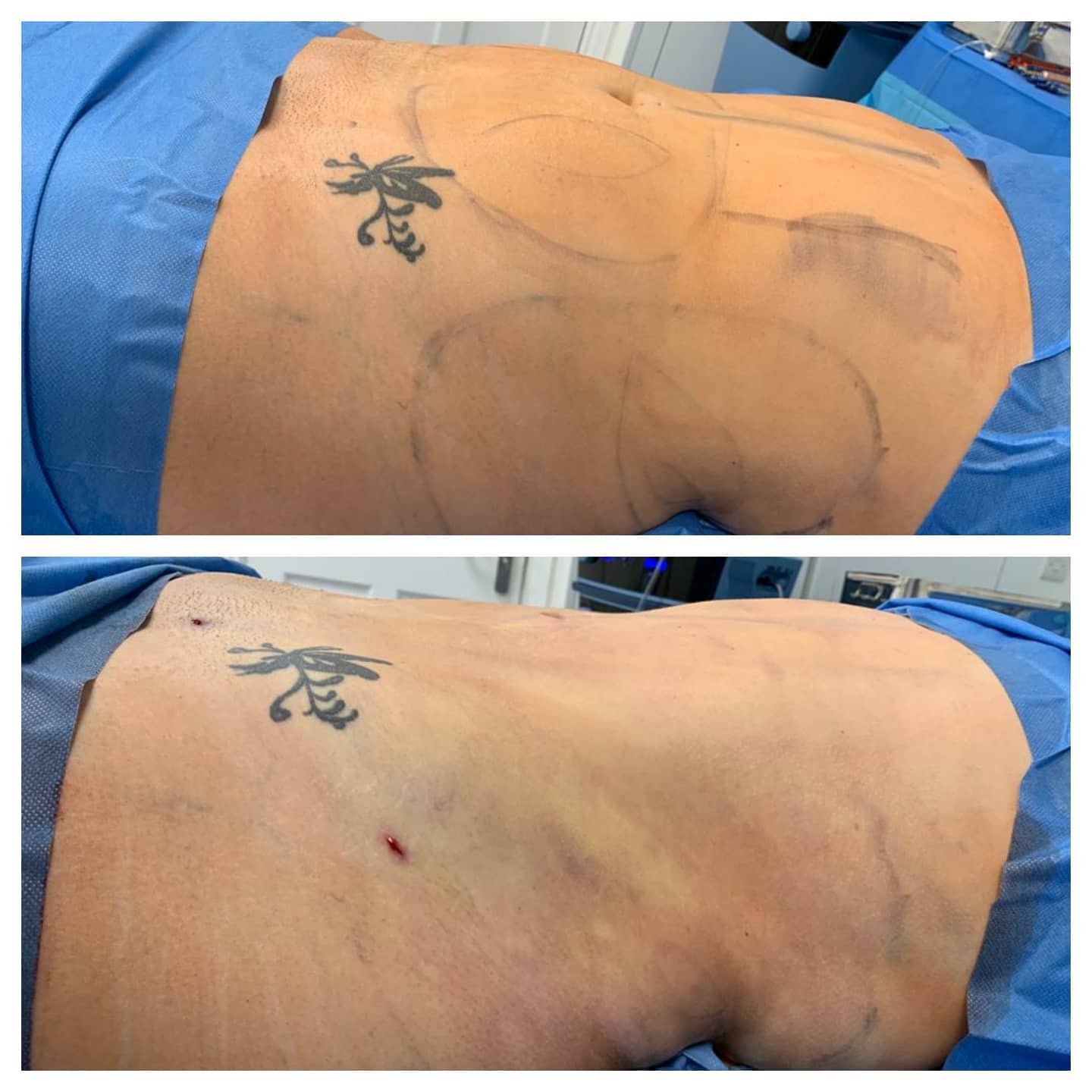 Quantum RF before and after 1